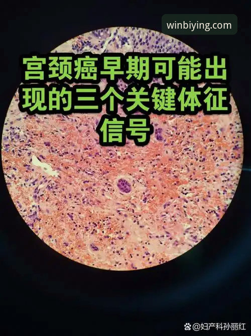 3个关键信号解读：奥尔西眼中的意大利足球裁判风波与帅位暗流